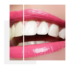 sbiancamento dentale- dentista bologna